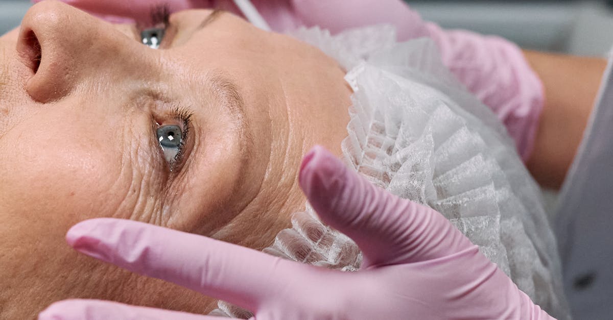Botox in the Lip Area: Enhancing Aesthetics Safely