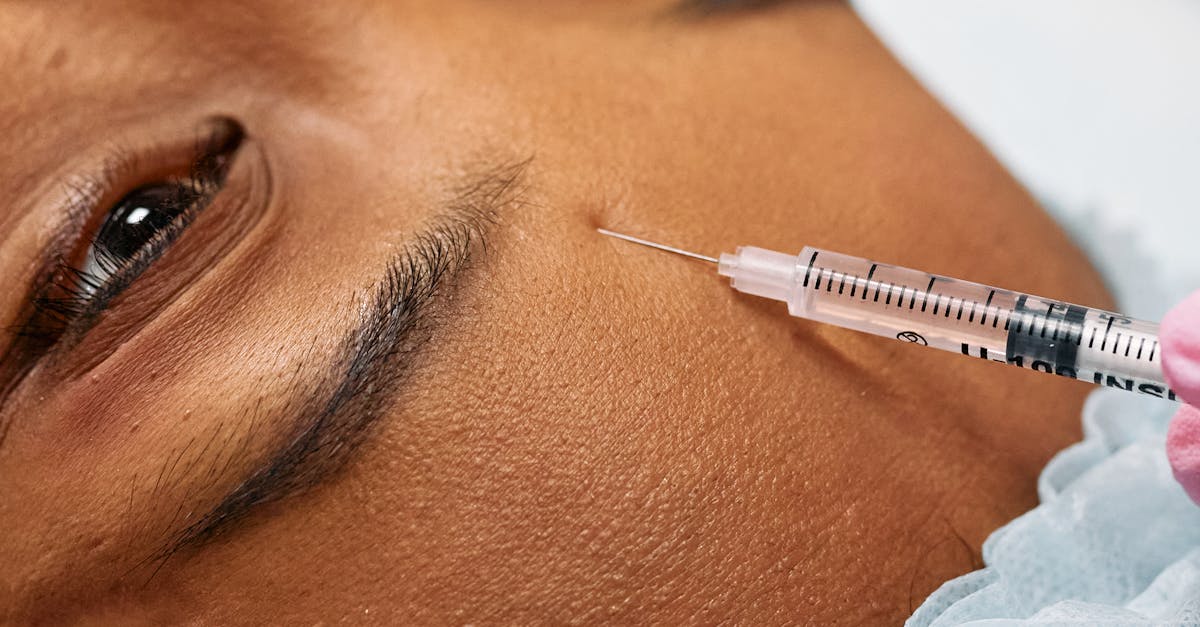 How to Identify Unusual Reactions After Botox